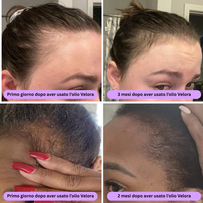 ™ - olio naturale per la crescita dei capelli