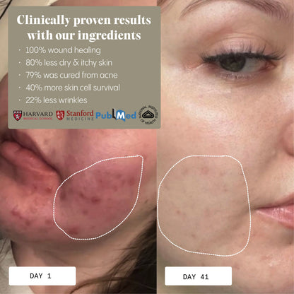 Zuiverende & Revitaliserende Gezichtsscrub