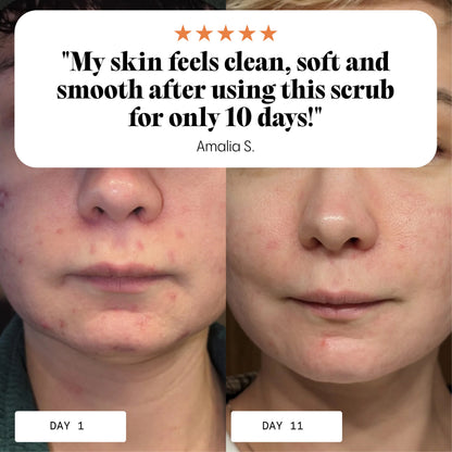 Zuiverende & Revitaliserende Gezichtsscrub