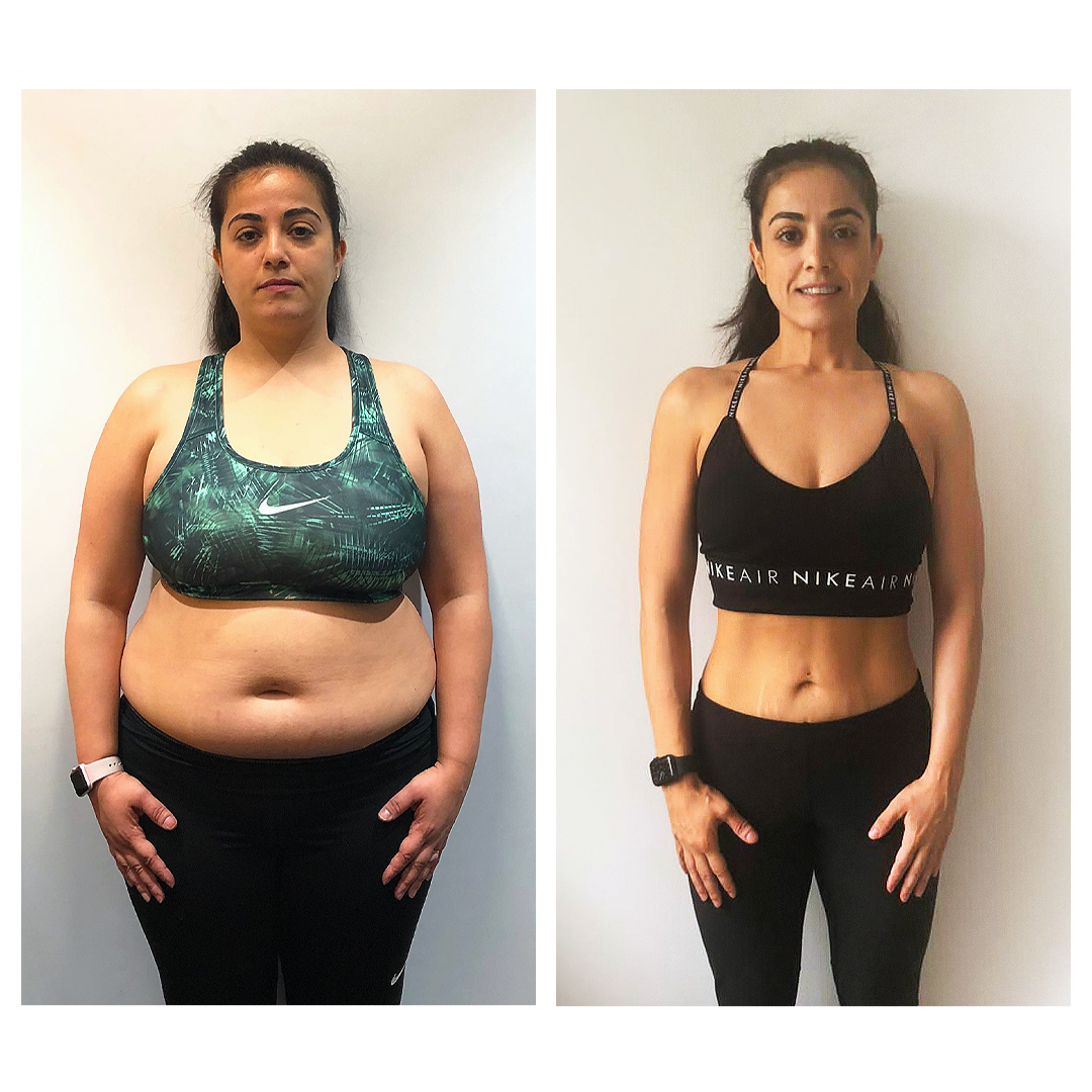 ™ Slimming Patches: Your Ally for a Slender Silhouette