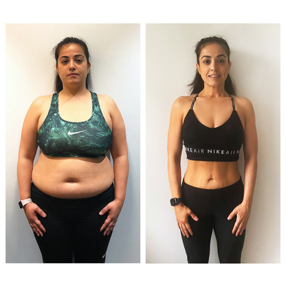 ™ Slimming Patches: Your Ally for a Slender Silhouette