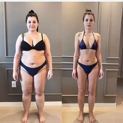 ™ Slimming Patches: Your Ally for a Slender Silhouette