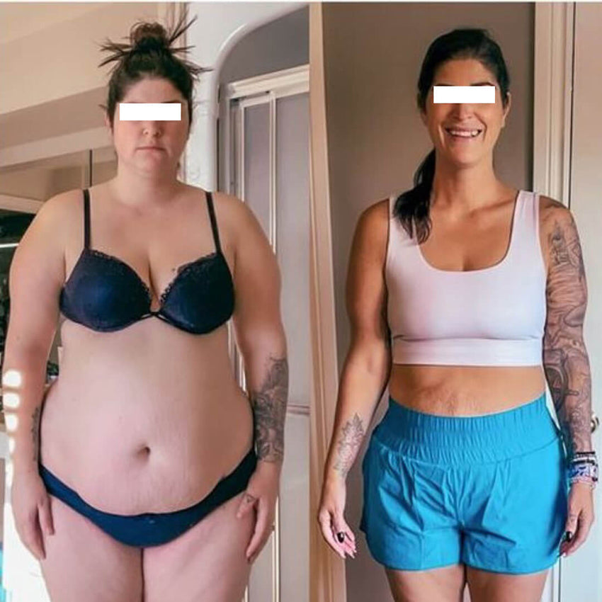 ™ Slimming Patches: Your Ally for a Slender Silhouette